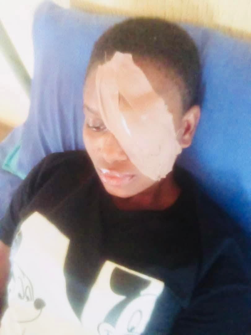 Cataract Surgery Support